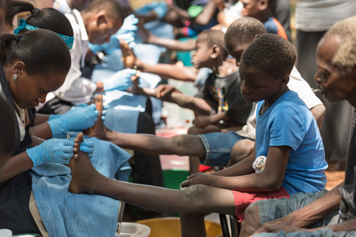 20150317_uganda-jigger-clinic_0233